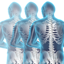 Chiropractic Malpractice Insurance